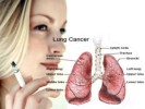 10 Interesting Lung Cancer Facts