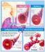 10 Interesting Asthma Facts