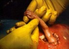 10 Interesting Abortion Facts