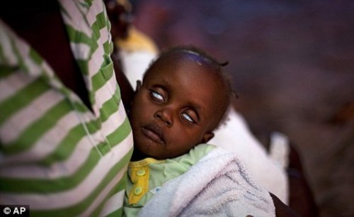 Cholera in Africa