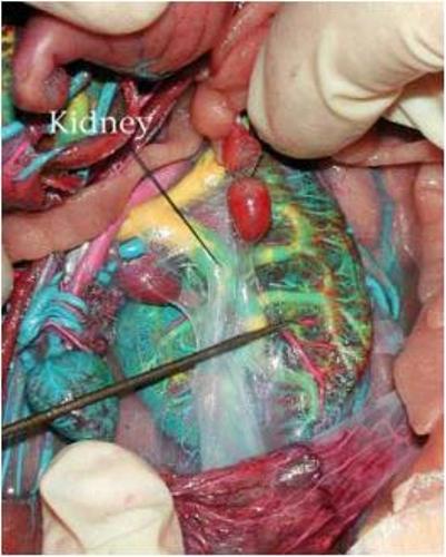 Excretory System Kidney