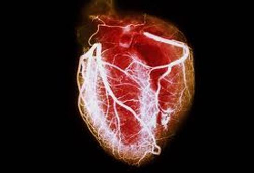 Heart Disease Pic