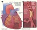 10 Interesting Heart Disease Facts