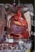 10 Interesting Heart Transplant Facts