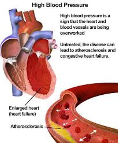 High Blood Pressure facts