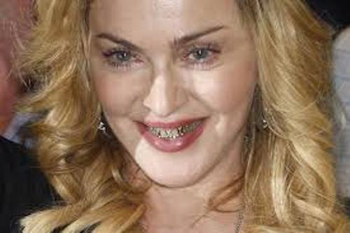 Madonna teeth