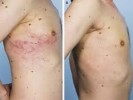 10 Interesting Melanoma Facts