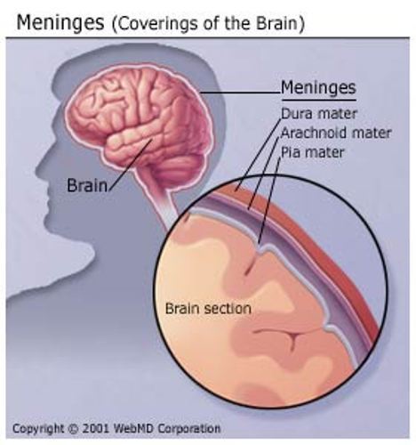 Meningitis disease