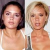 8 Interesting Plastic Surgery Facts