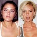 8 Interesting Plastic Surgery Facts