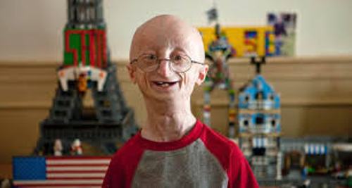 Progeria Facts