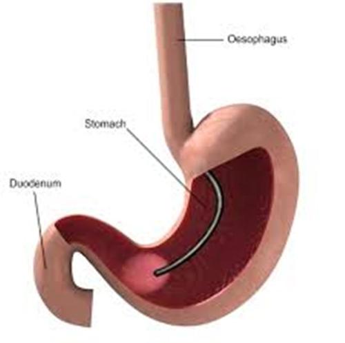oesophagus pictures